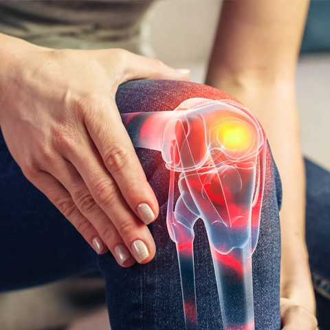 A person holding their knee. It is highlighted red and you can see the bone.